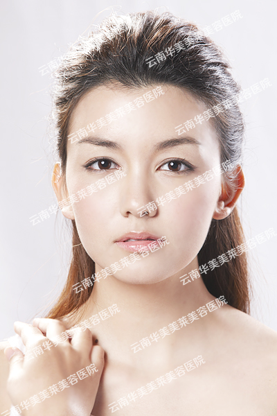双眼皮修复效果如何