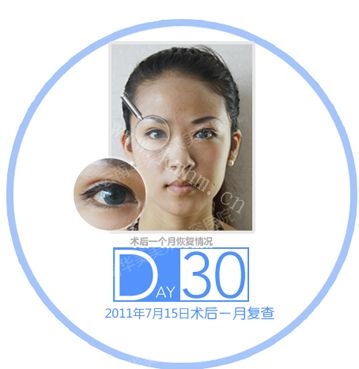 刘芸杉——“脱”单