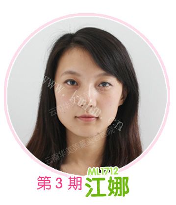 江娜：双眼皮果然电力十足