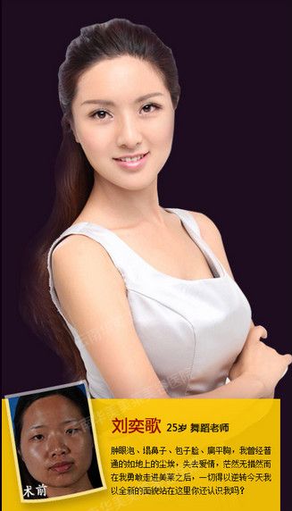 2014变美计划  美莱让你离家更近一步