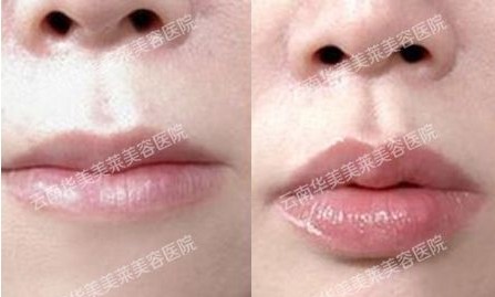 美莱微整形