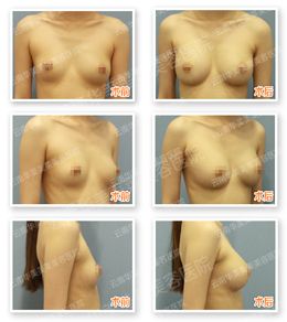 肥胖无胸自卑女生如何逆袭白富美