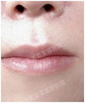 玻尿酸的作用