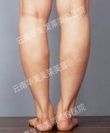 早春瘦腿法则  瘦腿两种方法
