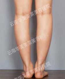 早春瘦腿法则  瘦腿两种方法