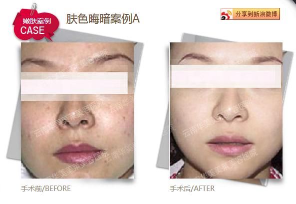 巧用橄榄油  完善细致肌肤
