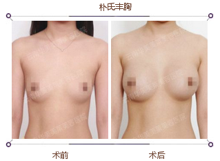 大师汇聚美莱美胸专场  你的胸还好吗？