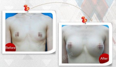 深V动感丰胸  天生美胸如此简单