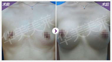 女神深V内衣萌笑谁更抢镜