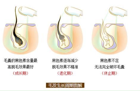未雨绸缪，美莱反季节脱毛抢先行