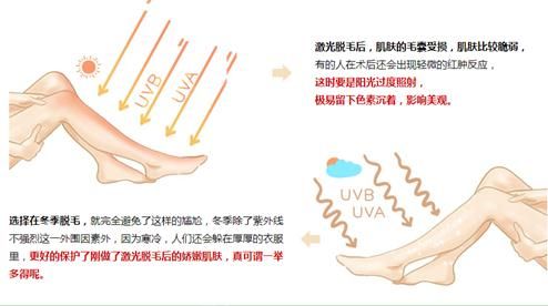 未雨绸缪，美莱反季节脱毛抢先行