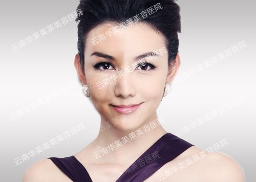 假体隆鼻后疤痕明显吗