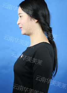 满街竹签腿，如何瘦成一道闪电？