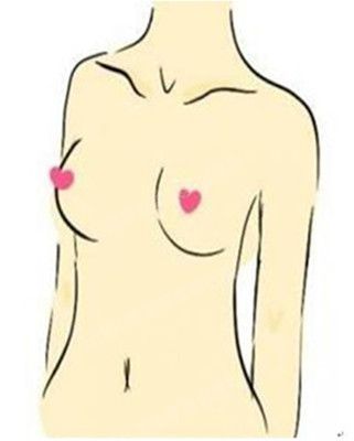 丰胸