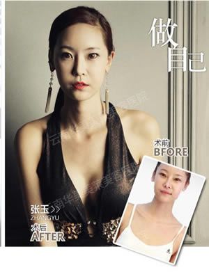 民国隆胸术，民国女人真会玩！