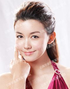 割双眼皮，如何一刀现美丽？