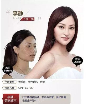 华美美莱