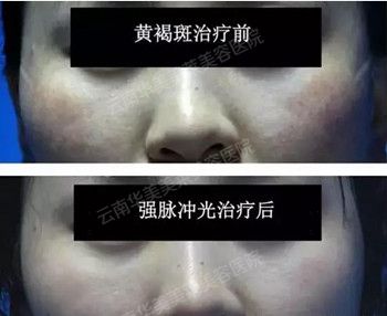 华美美莱