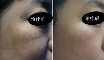 华美美莱