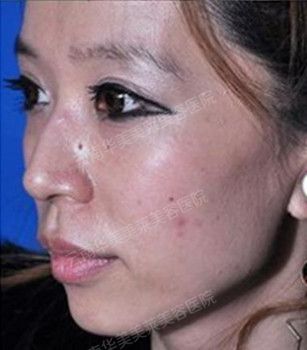 张雪儿