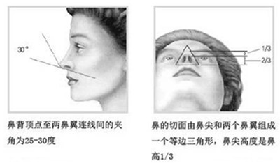 不美鼻形