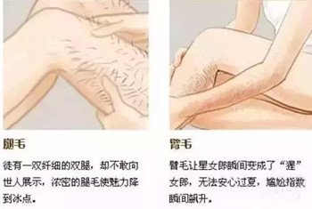 脱毛