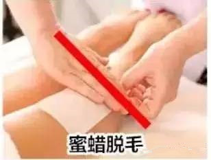 脱毛