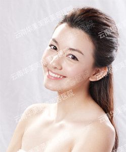瘦脸针