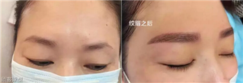 肖娟