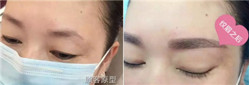 肖琛