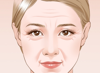 塑美极