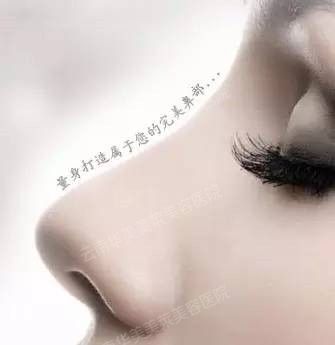 假体隆鼻