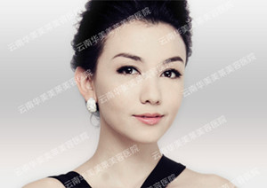彩光嫩肤治疗皮肤暗黄