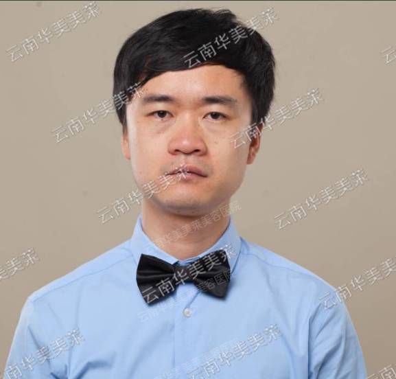 员工整形秀