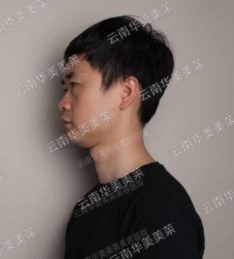 员工整形秀