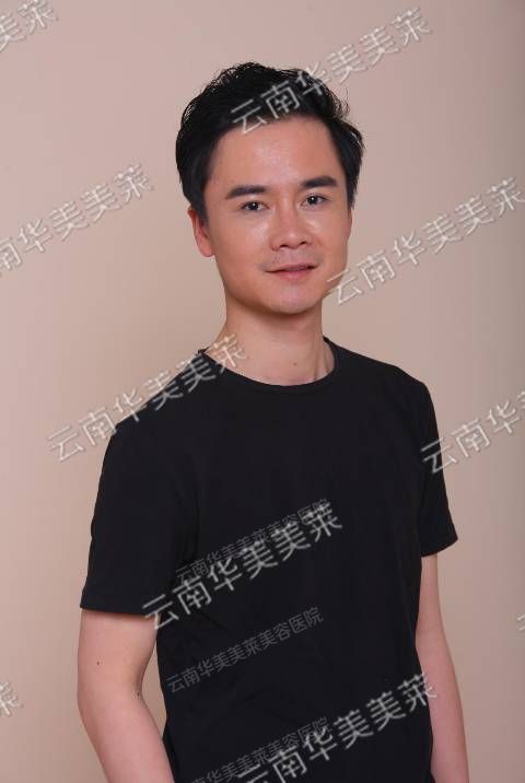 员工整形秀