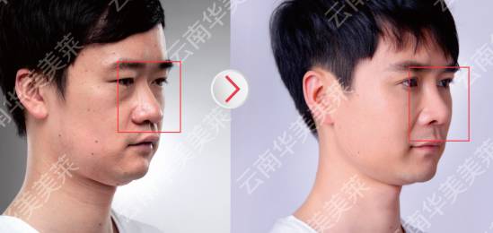 员工整形秀
