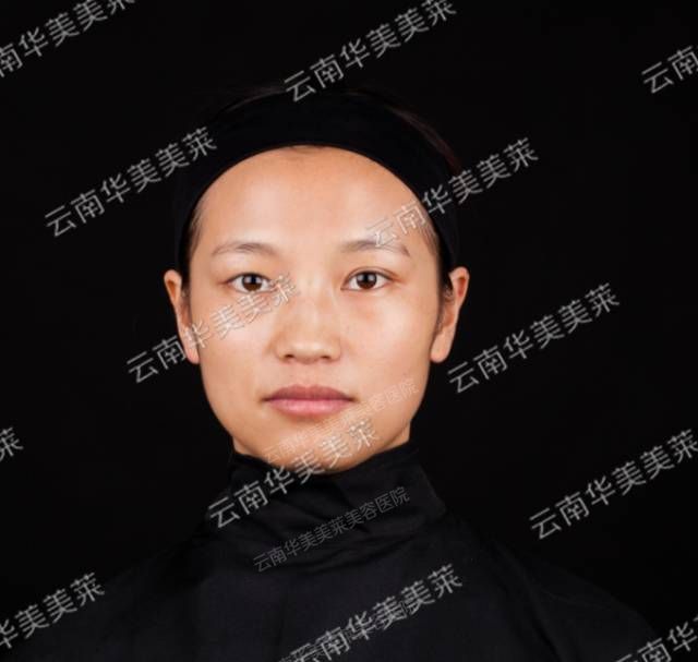 员工整形秀
