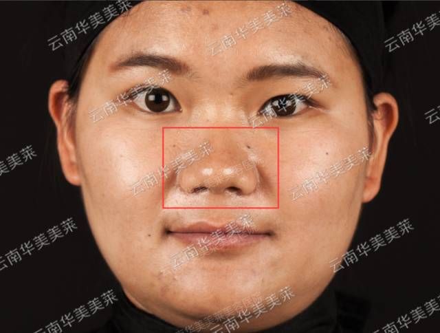员工整形秀