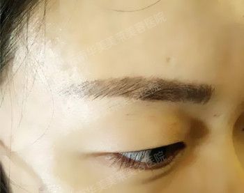 昆明美莱纹眉值得信赖吗？
