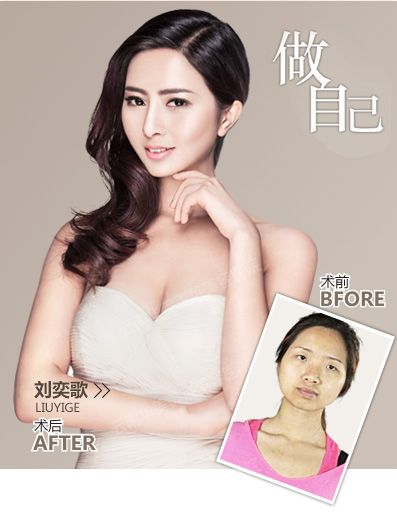 乳晕漂红