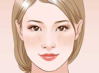 色斑总爱光顾女性，这是为什么呢？
