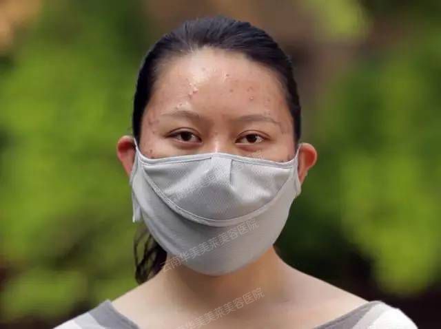 ▶视频丨央视大专辩论赛女辩手 三年“无脸见人”的元凶是