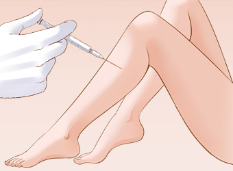 注射BOTOX瘦腿
