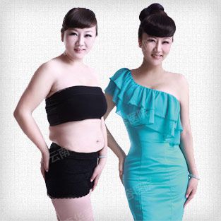 吸脂手术应该注意什么问题？