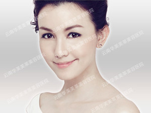 BOTOX除皱