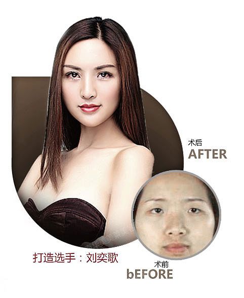 双眼皮方法