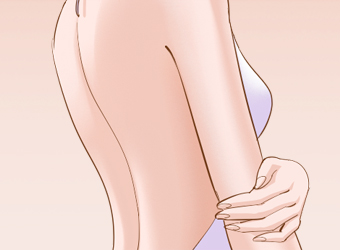 激光脱毛效果